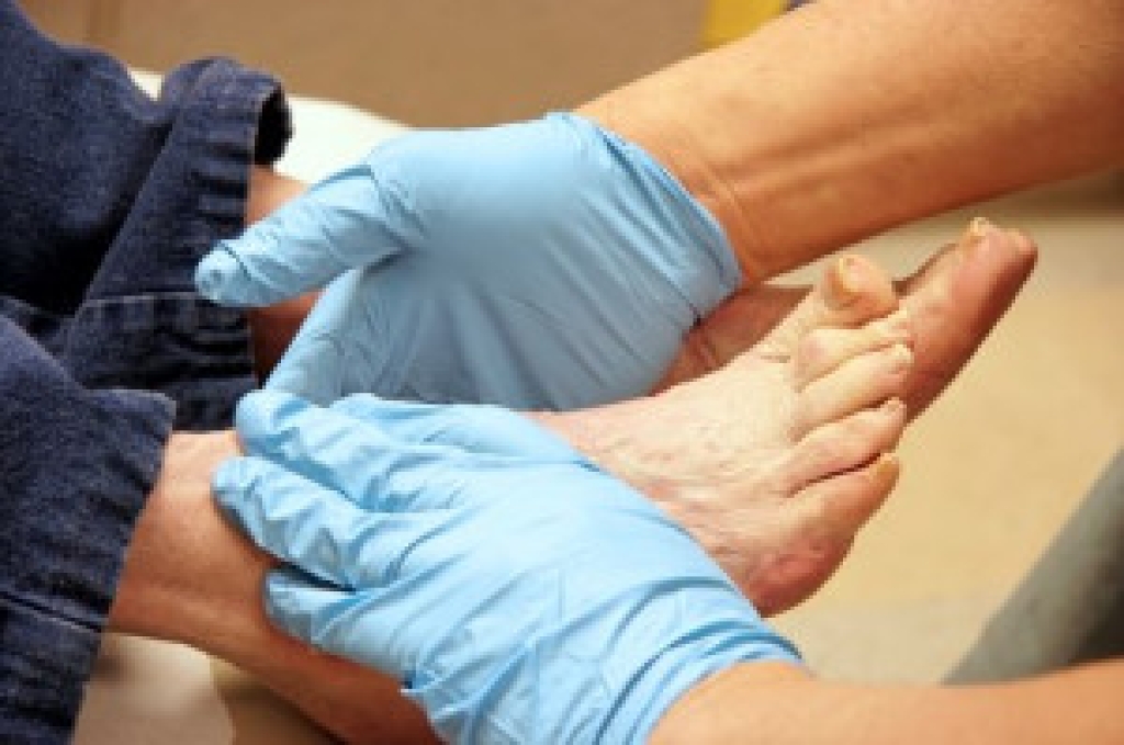 Importance of Diabetic Foot Care