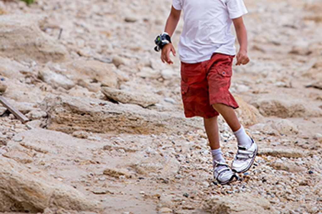 How Podiatrists Diagnose and Treat Clubfoot in Babies