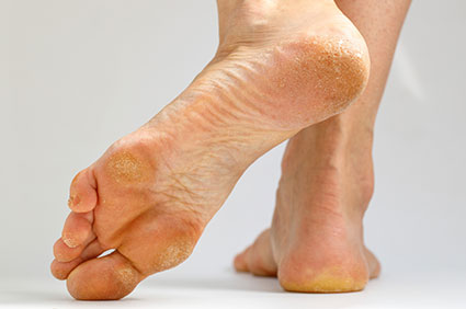 skin conditions