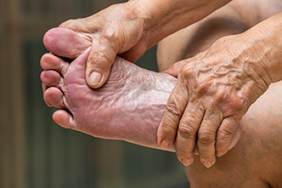 Common Foot Problems and Foot Protection in Seniors