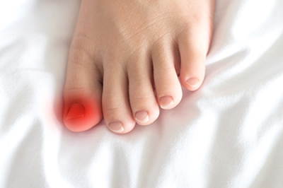 A Trusted Surgical Option for Ingrown Toenails