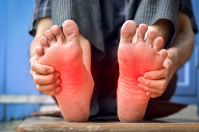 Weill Marchesani Syndrome and Its Effects on the Feet