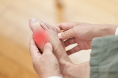 Gout Causes and Podiatric Care